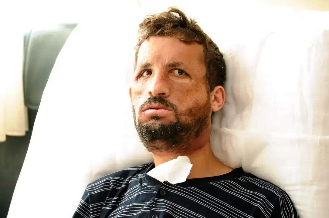 Manavgatlı Uğur Acar: 'Yüzünü Aldığım Kişinin Yaşındayım' 7